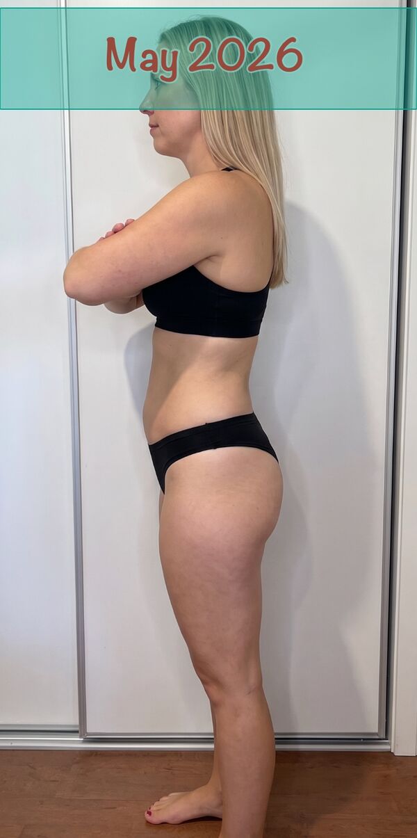 Dr. Laura Bennett fourteen months after her final injection.