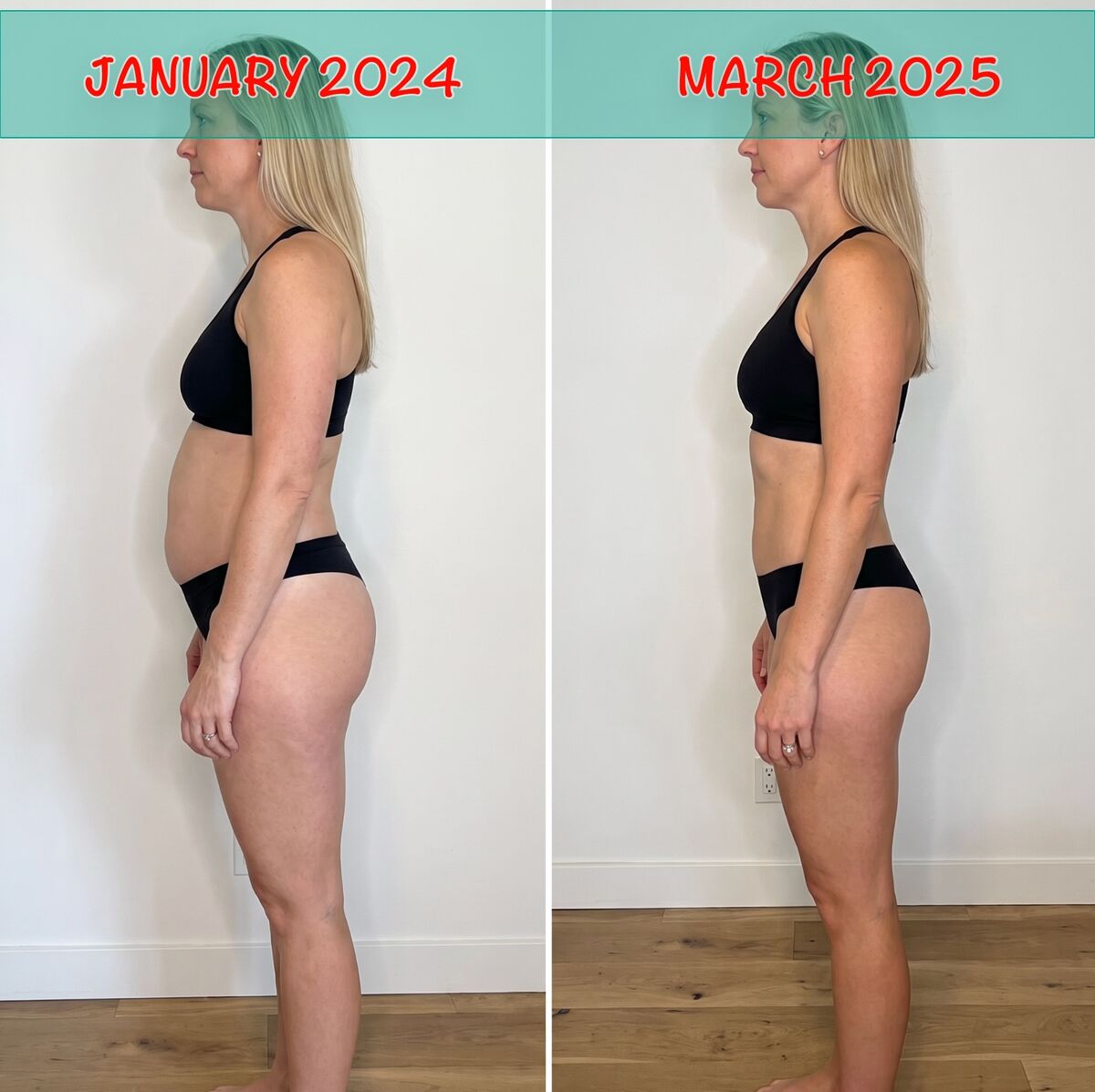 Dr. Laura Bennett before and at her final injection.